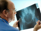 New Orleans Orthopedic Surgeon