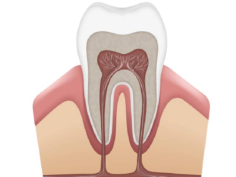Get Your Smile Back With a Painless Root Canal Treatment