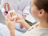 dental implant garland