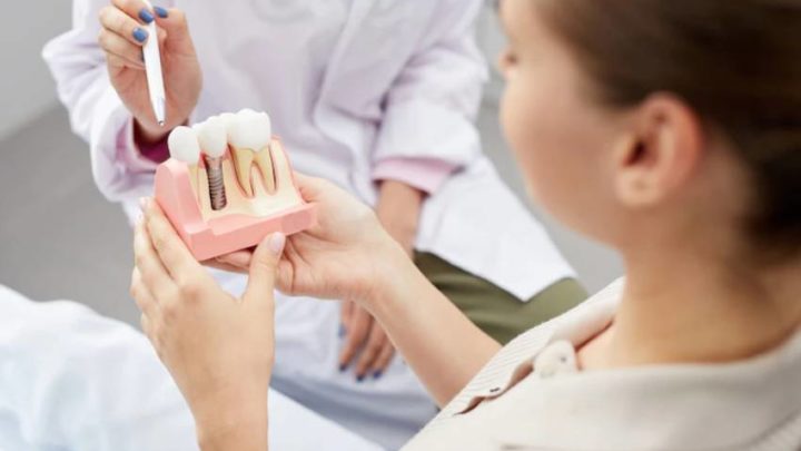 New Smile, New You: An Overview Of Dental Implants